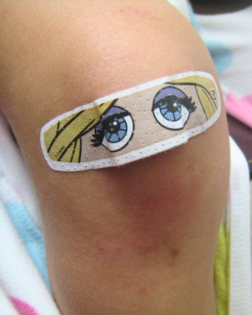 miss piggy band aid on sore knee.