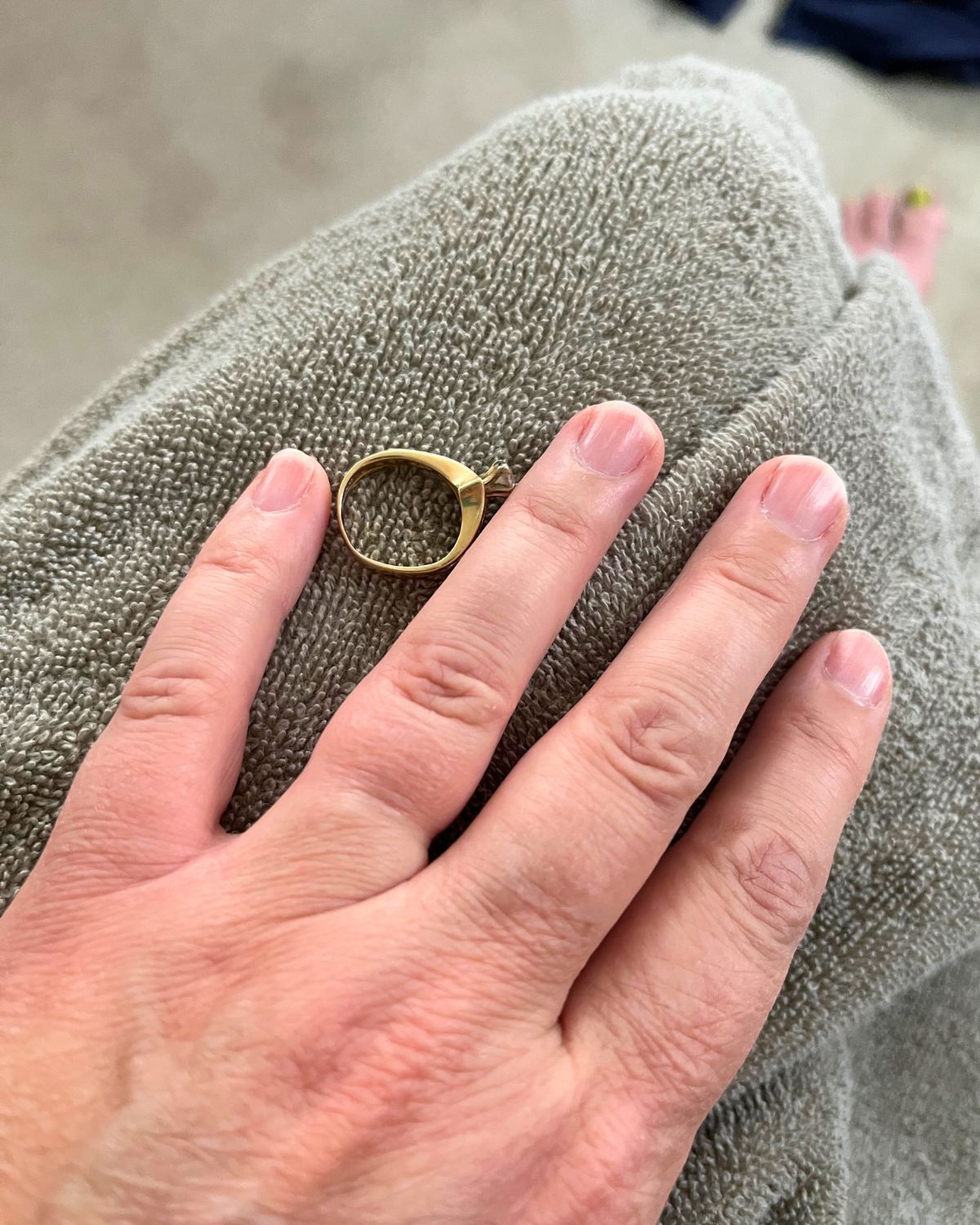 ring resting on robed knee next to swollen finger.